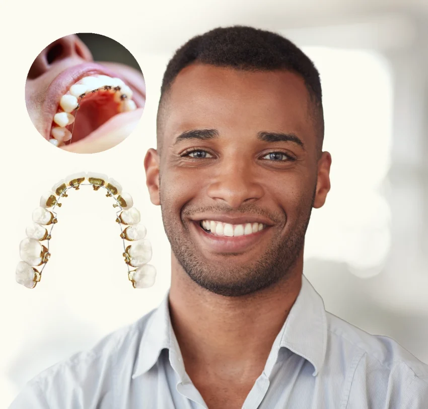 Best Age To Get Dental Braces For Kids And Teens